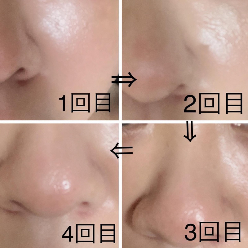 TINH CHẤT VI KIM TẨY DA CHẾT TÁI TẠO CĂNG BÓNG VT REEDLE SHOT 50ML