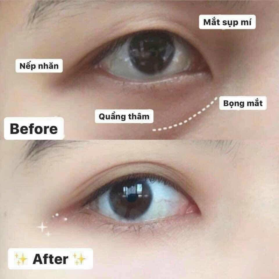 Kem Dưỡng Mắt Kèm 3 Đầu Thanh Lăn Massage LAMELIN