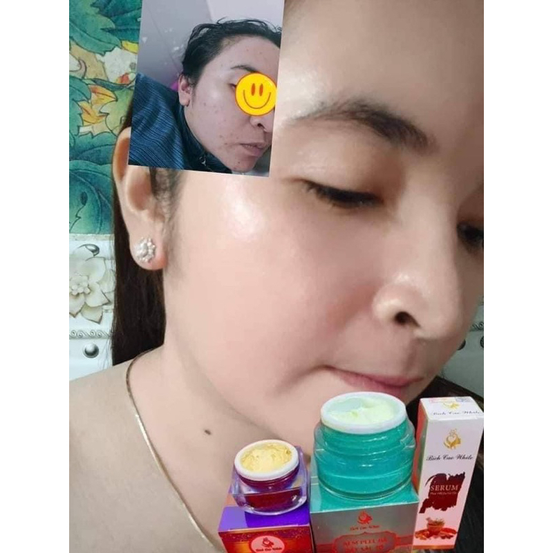 Kem peel da bich cao white