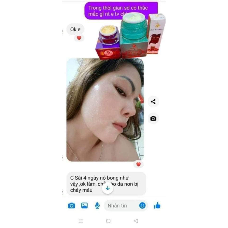 Kem peel da bich cao white