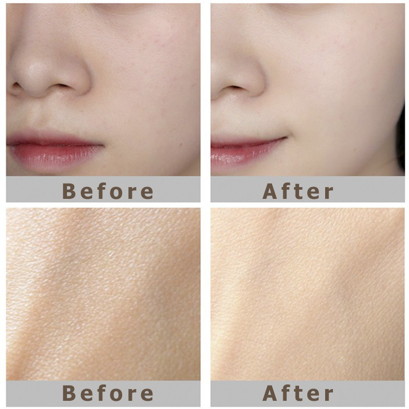 Kem và Gel dưỡng ẩm Clinique Dramatically Different Moisturizing Gel Lotion+ Jelly 125ml