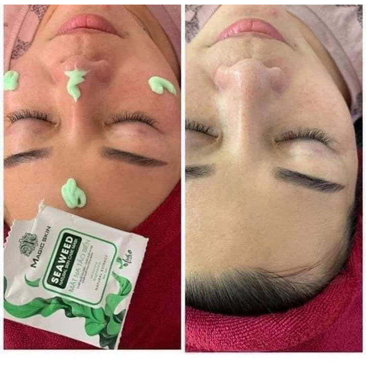 Cấy trắng da tảo biển tươi siêu mịn, siêu trắng