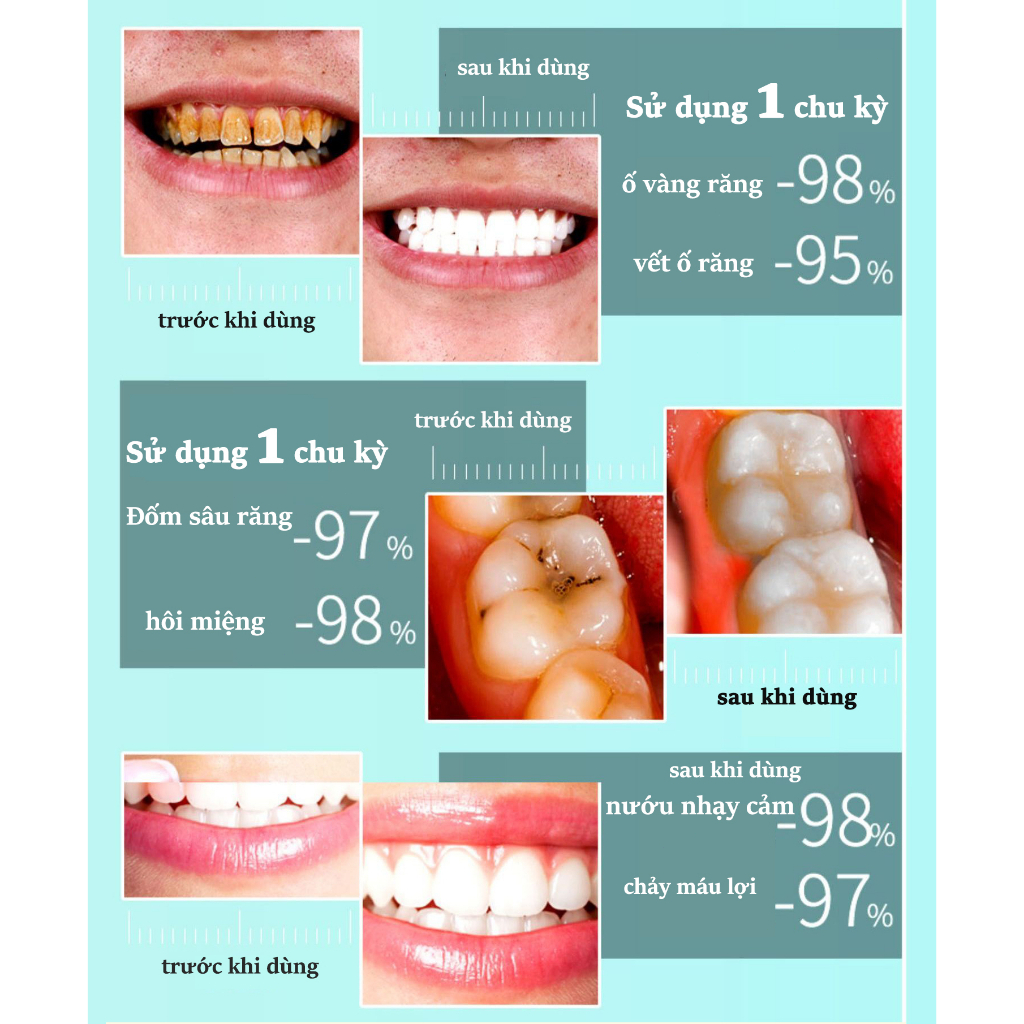 Kem đánh răng trăng răng kem đánh răng men vi sinh 250g xóa sạch cao tăng chống sâu răng thơm mát hơi thở