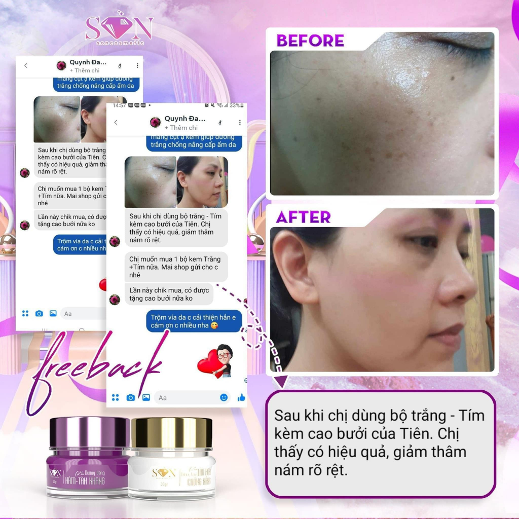 Kem Face SON Chống Lão Hóa Nám Da - Nguyễn Tiên, Tặng Cao Bưởi & Thẻ Cào