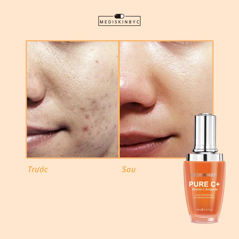 KEM VÀ SERUM PURE C MEDISKINBYC HÀN DƯỠNG TRẮNG SÁNG MỊN DA
