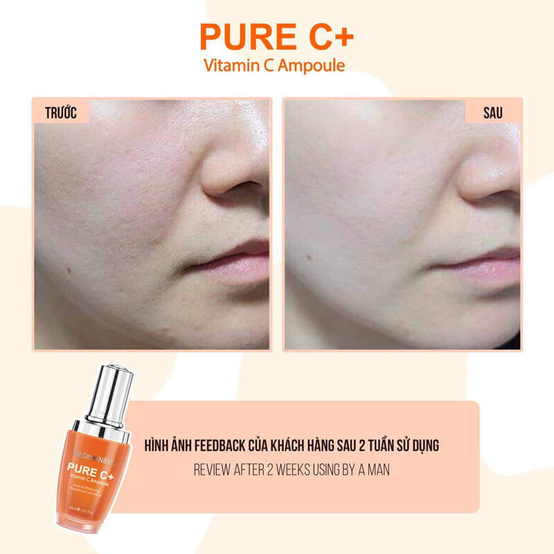 KEM VÀ SERUM PURE C MEDISKINBYC HÀN DƯỠNG TRẮNG SÁNG MỊN DA