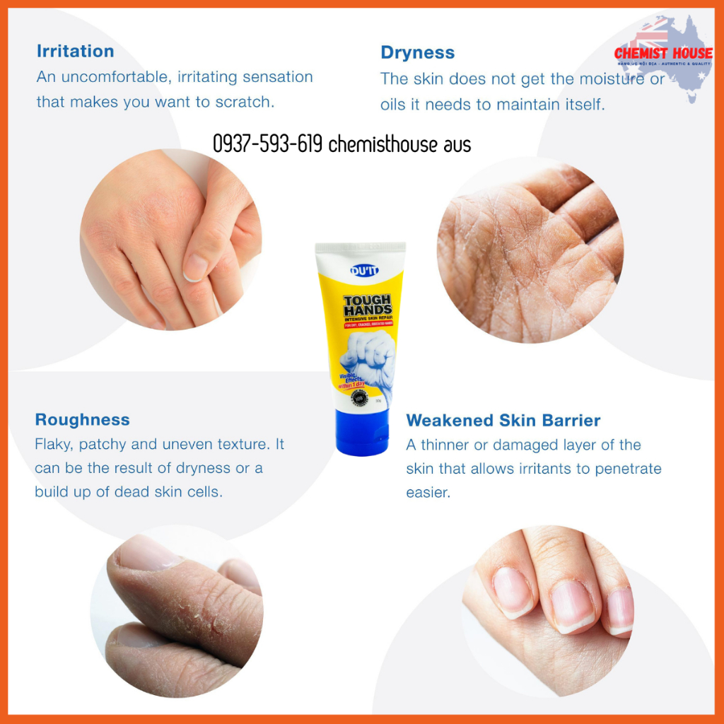 [150gr] Kem Dưỡng Da Tay Đặc Biệt Cho Da Khô Nứt Nẻ Hư Tổn 150gr - DU'IT Tough Hands Intensive Hand Cream 150Gr