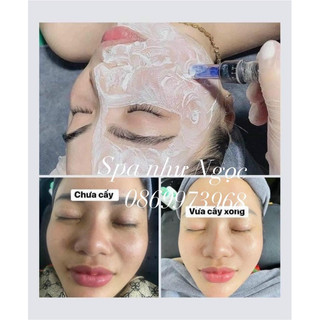 MẦM Ủ TRẮNG MẶT BODDY (hàng cấy trắng của spa)