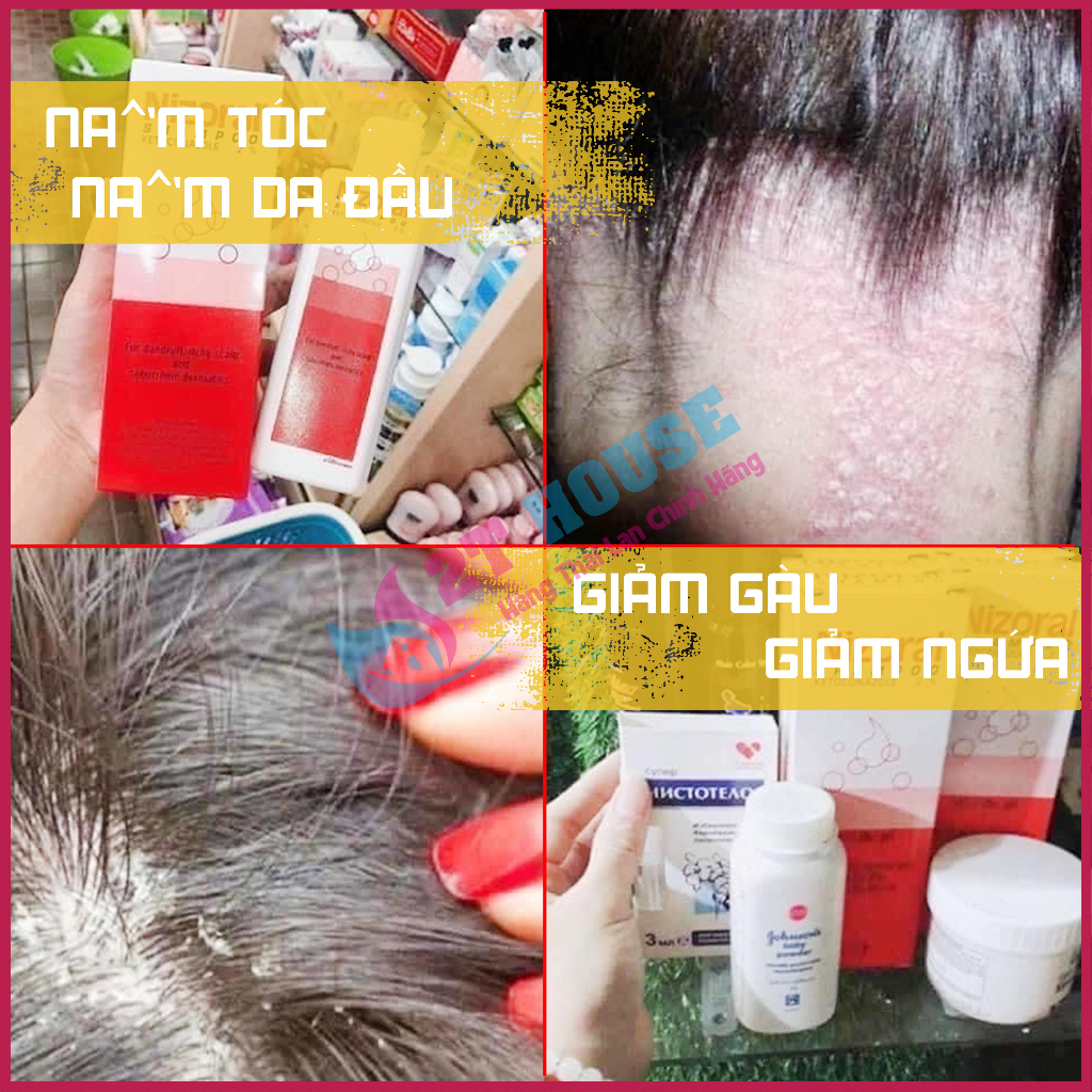 Dầu gội đầu giảm gàu/ngứa da dầu/nấm tóc Niz Thái Lan oral chai 50ml/100ml 2T House Shop Hàng Thái Lan Nội Địa
