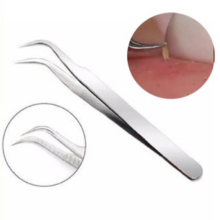 Nhíp gắp mụn thần kì