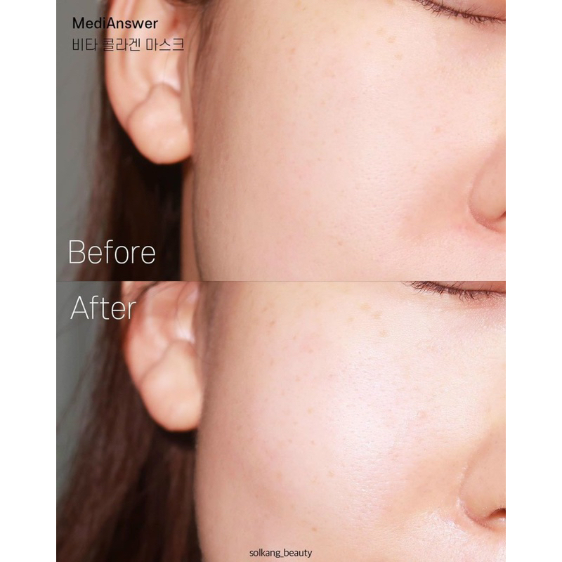 Mặt nạ thạch vàng Filler collagen 83% medianswer vita collagen mask	.