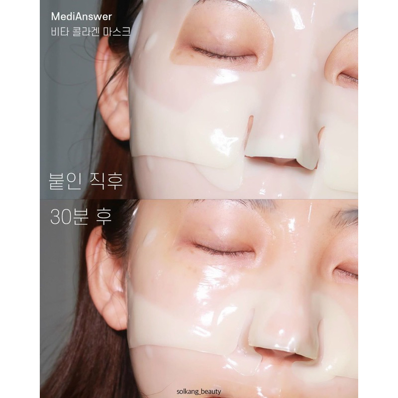 Mặt nạ thạch vàng Filler collagen 83% medianswer vita collagen mask	.