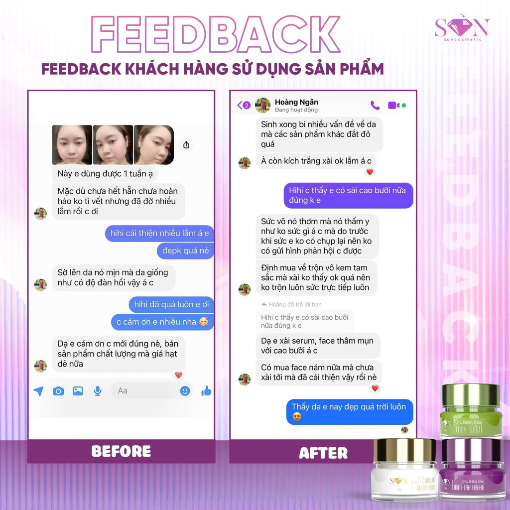 Combo face mụn, trắng da SON Nguyễn Tiên chính hãng