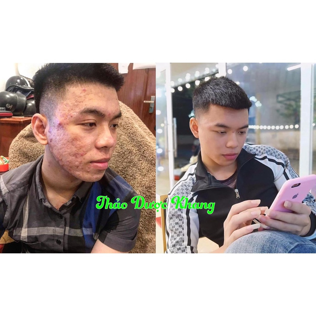 Combo trăng da dưỡng ẩm cấp ẩm  cho da giúp da mịn màng căng bóng Thảo Dược Khang _ TDK SKIN