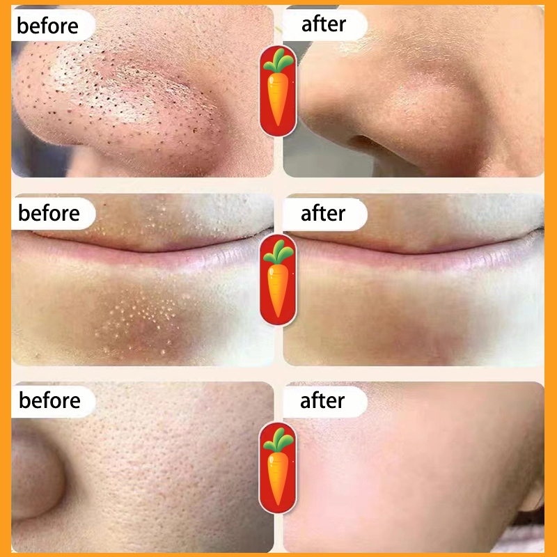 Mặt nạ sủi bọt Loại bỏ mụn đầu đen mặt nạ đất sét Mặt nạ cấp ẩm 4g*12pcs làm sạch lỗ chân lông Làm sáng màu