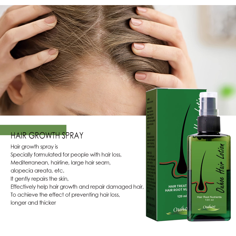 Tinh chất mọc tóc NEO HAIR LOTION, serum Neo Hair kích thích mọc tóc nhanh, hết hói đầu, chống gãy rụng 120ml