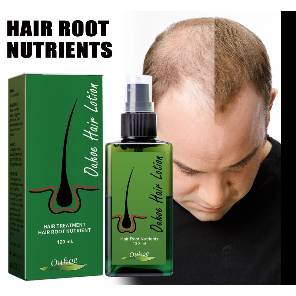 Tinh chất mọc tóc NEO HAIR LOTION, serum Neo Hair kích thích mọc tóc nhanh, hết hói đầu, chống gãy rụng 120ml