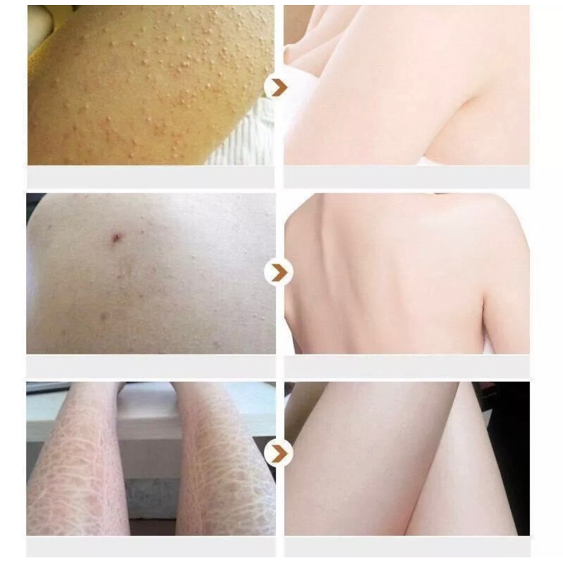 Tẩy Tế Bào Chết Toàn Thân MEIDIAN , Tẩy Da Chết Nhẹ Hỗ Trợ Làm Sạch Sâu Thành Phần Naiacinamine 250g Chính Hãng