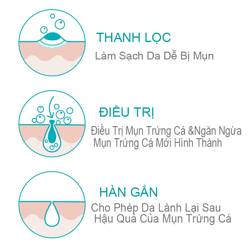 Sữa rửa mặt Cerave Acne Foaming Cream Cleanser 150ml