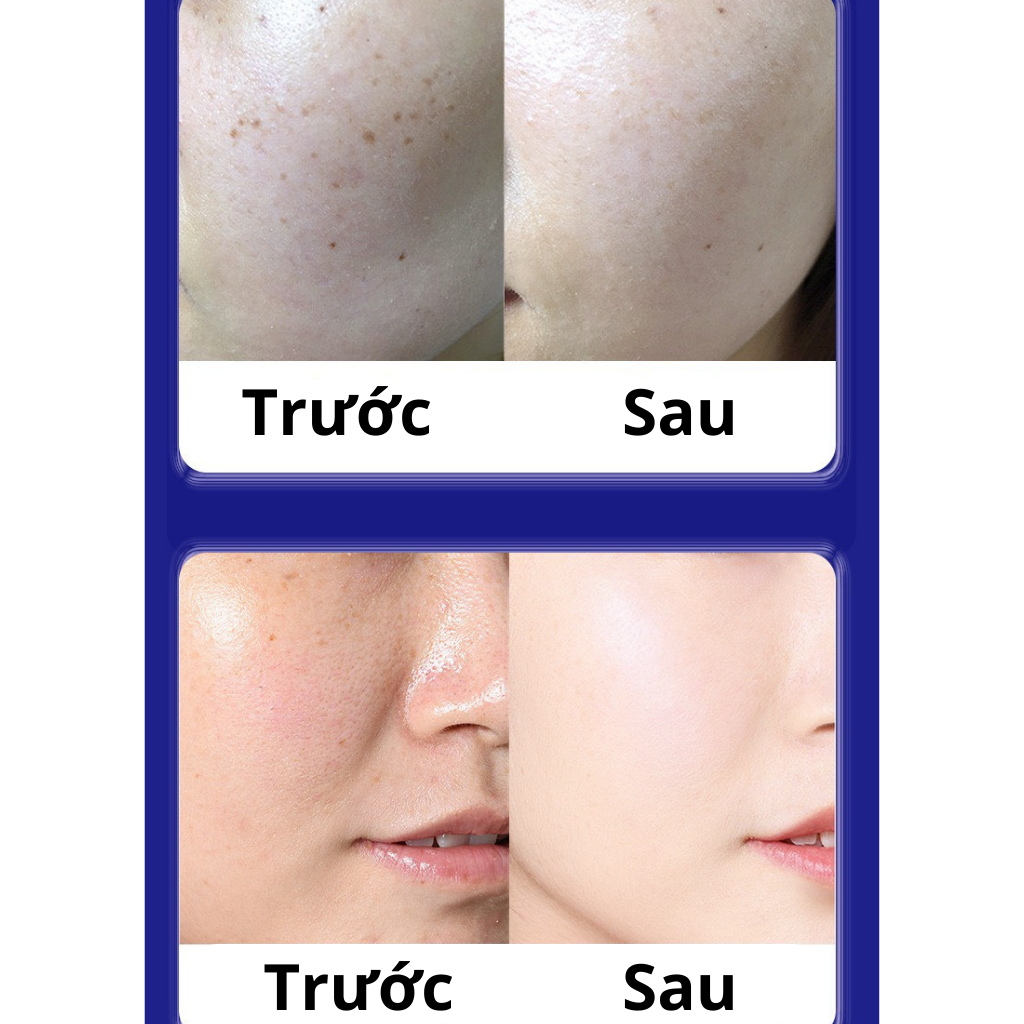 Kem UCM xóa nhăn, mờ nám trẻ hóa làn da nội địa Nhật