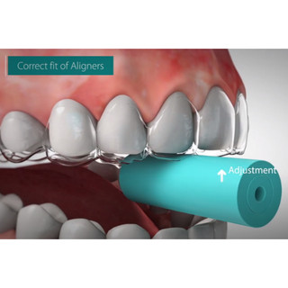 Chewies cắn đệm Invislign, miếng cắn chewy cho máng niềng răng trong suốt