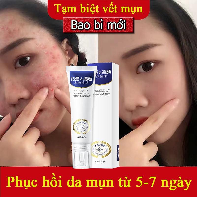 Kem thâm mụn 30g gel ngừa mụn dưỡng ẩm làm sáng da làn da mịn màng dùng cho mụn viêm, mụn bọc, mụn mủ, mụn trứng cá