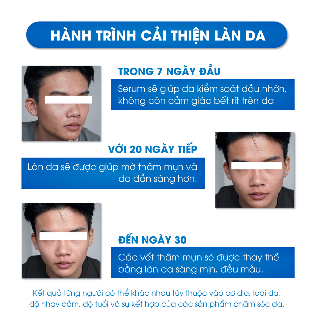 Serum trắng da mờ thâm se khít lỗ chân lông o’vita light Oriskin 10ml