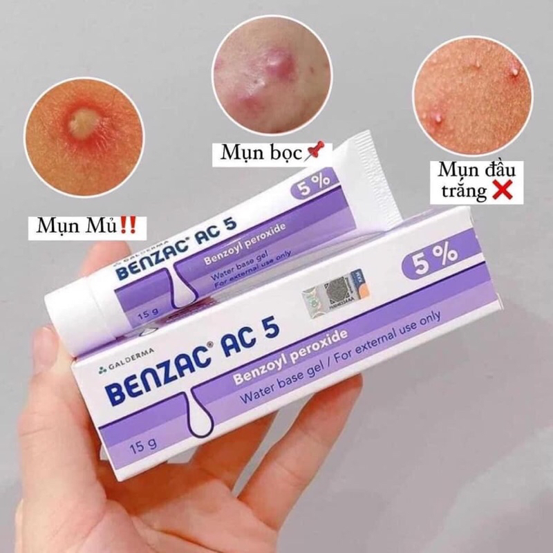 ✔️Kem Giảm Mụn Benzac AC 5% Benzoyl Peroxide 15g