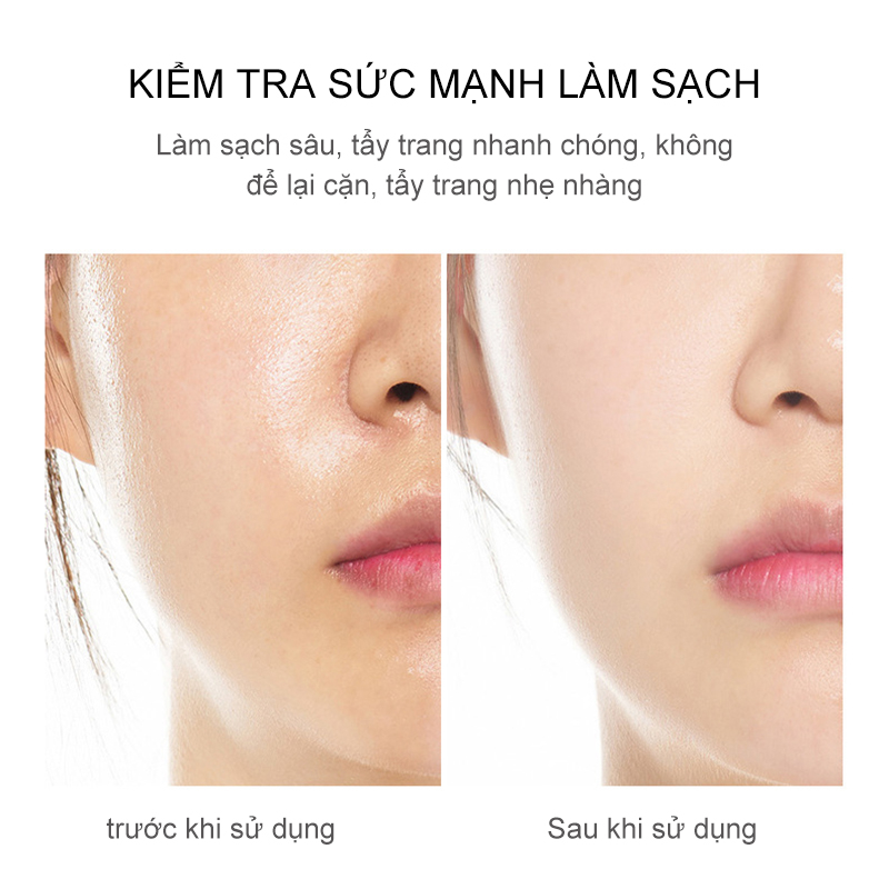 Nước Tẩy Trang nước làm sạch sâu và tẩy trang cho da nhạy cảm 300ml-URBFZXZY