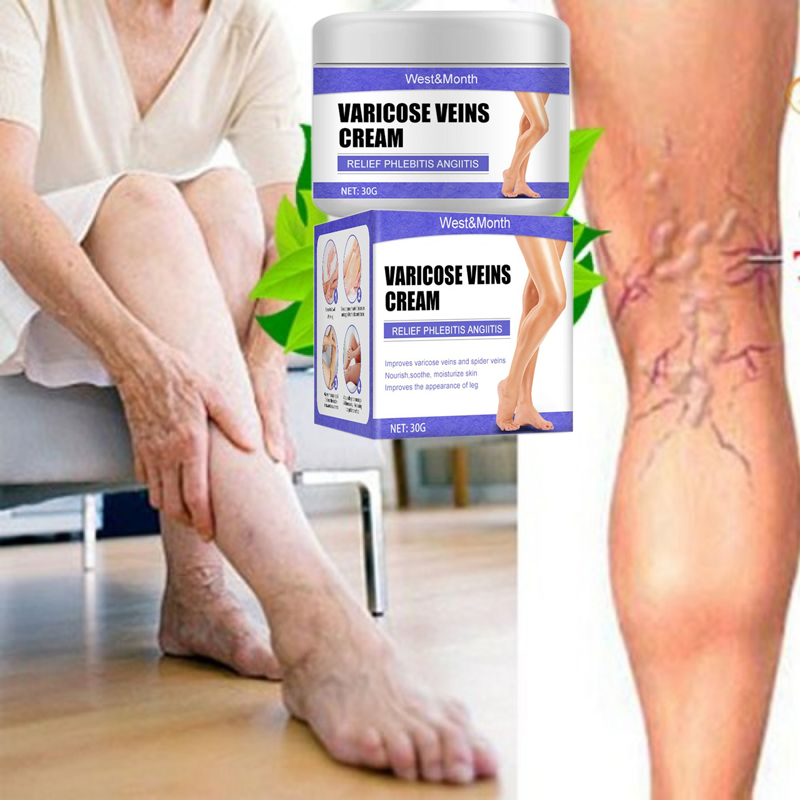 Kem Thảo Dược Hỗ Trợ Giảm Giãn Tĩnh Mạch Chống Giãn Tĩnh Mạch Làm Dịu Chân