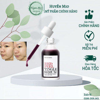 Serum peel da hóa học RED PEEL TINGLE SERUM - PEEL DA KHÔNG BONG TRÓC -Huynmio