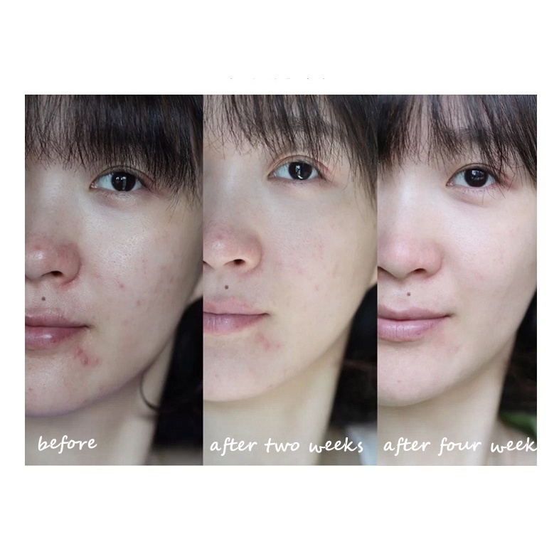 Serum Estee Lauder Night Advanced Repair bản mới 7ml-50ml EST001