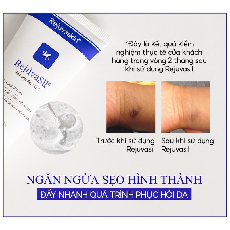 Gel làm xẹp sẹo lồi, sẹo phì đại Rejuvasil 10ml