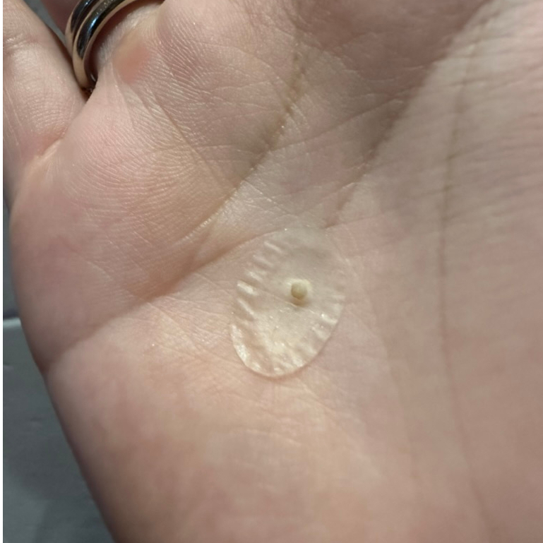 Miếng dán mụn COSRX mới