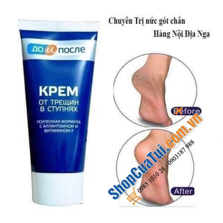 KEM GÓT CHÂN APTEKA KPEM 50ml