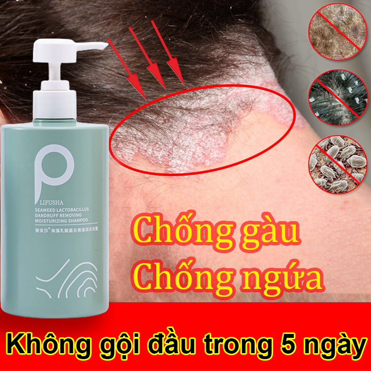Dầu gội trị gàu Dầu gội đầu Dầu Gội Muối Biển 500ml cải thiện tóc hư tổn dầu gội giảm ngứa Sạch Gàu Và Giúp Tóc Bồng Bền