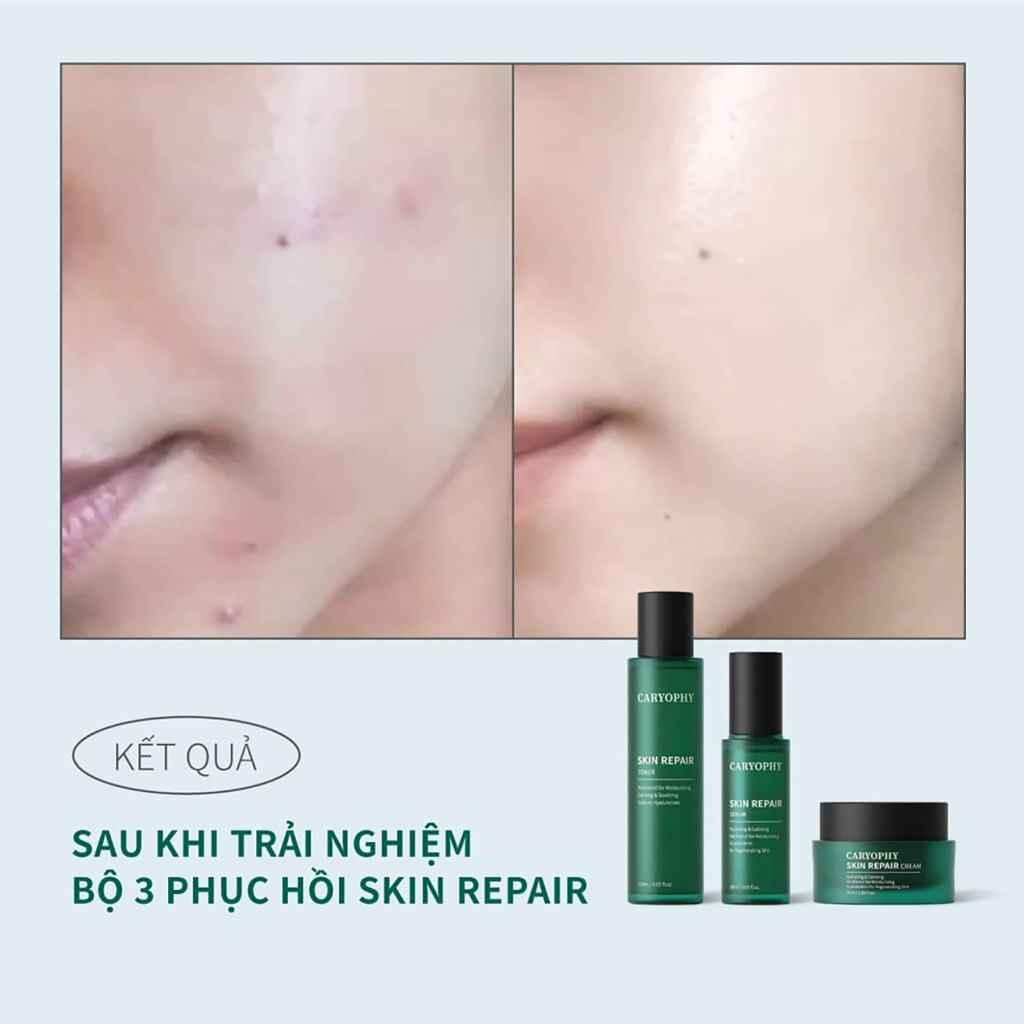 Kem dưỡng ẩm phục hồi da tổn thương Caryophy Skin Repair Cream Hàn Quốc giúp da mềm mịn 50ml