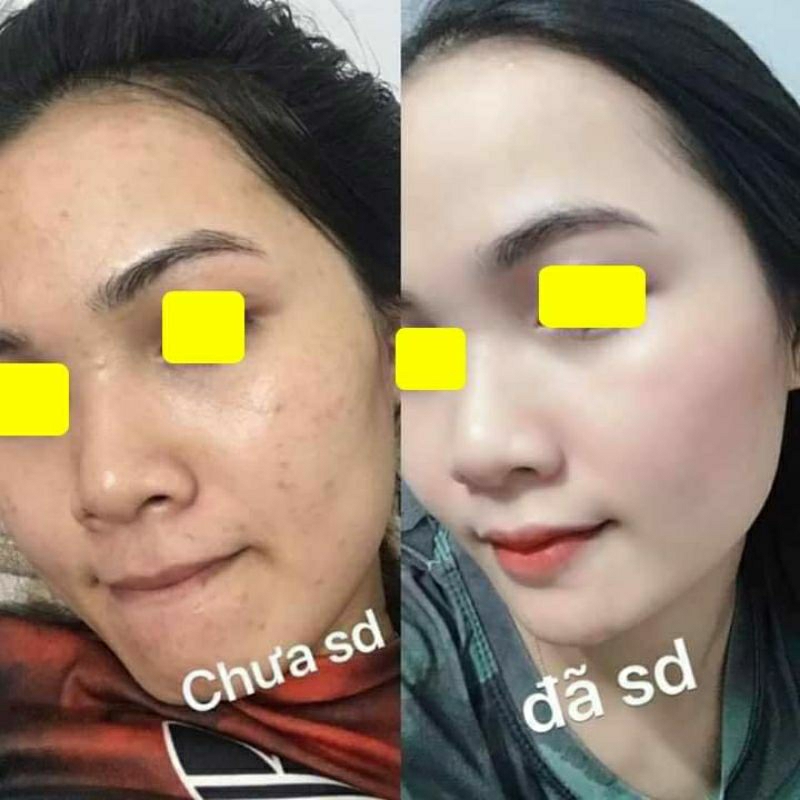 Serum sữa trắng da, căng bóng,phục hồi da chống lão hoá
