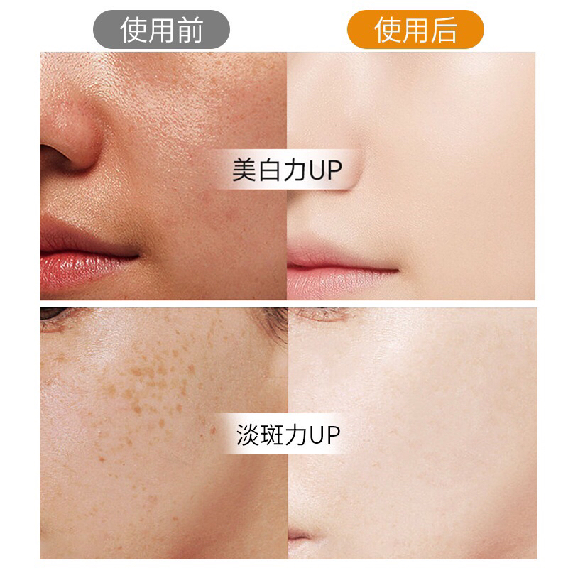 Tinh chất Làm sáng hắc tố melanin các đốm nâu làm mờ vết nám , làm sáng các đường rõ rệt, làm trắng và sáng da,