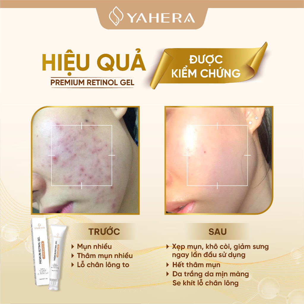 Bộ đôi giảm mụn và dưỡng trắng da YAHERA Gồm Gel chấm mụn 15g và serum dưỡng trắng 30g