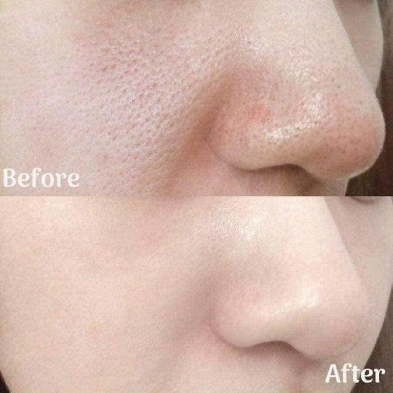 Chai chiết 30ml, Fullsize 148ml