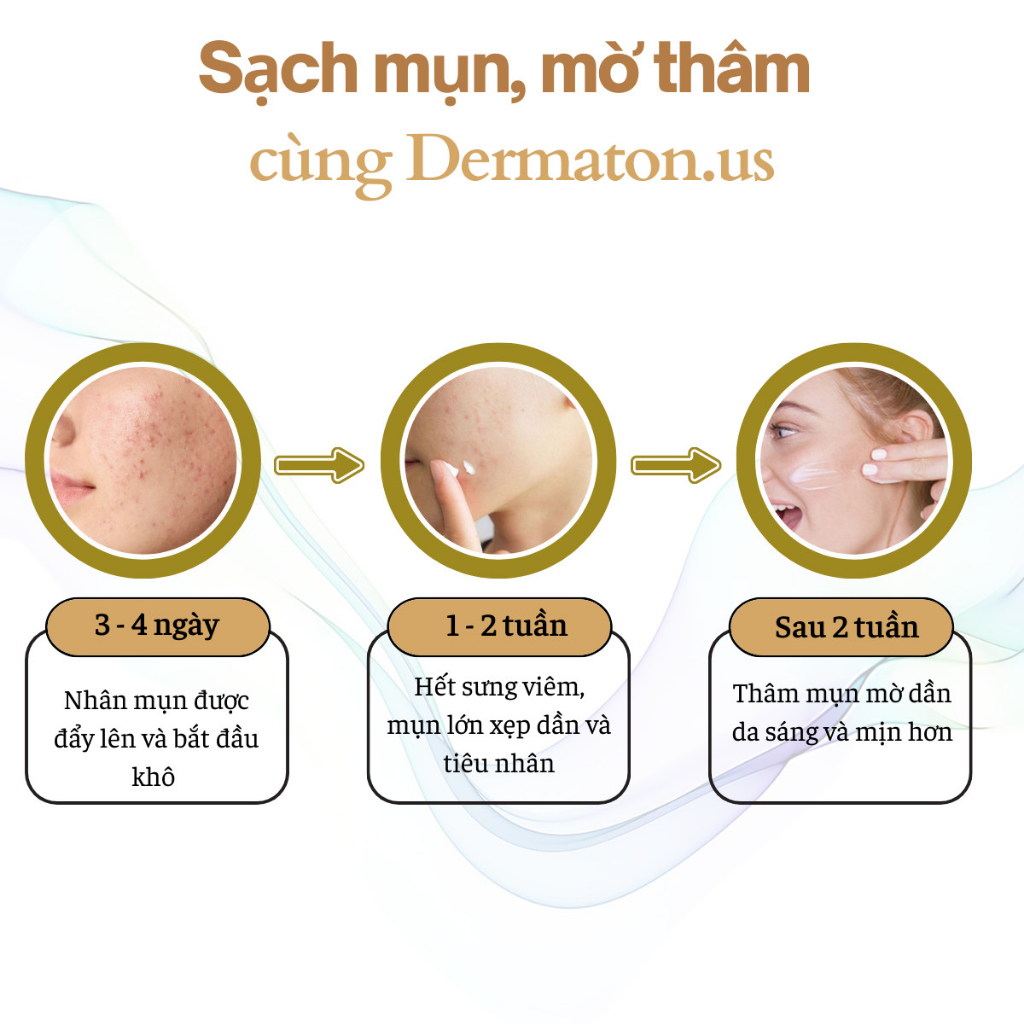 Kem ngừa mụn thâm Dermaton US Gamma Chemicals, giảm sẹo mụn trứng cá từ thảo dược