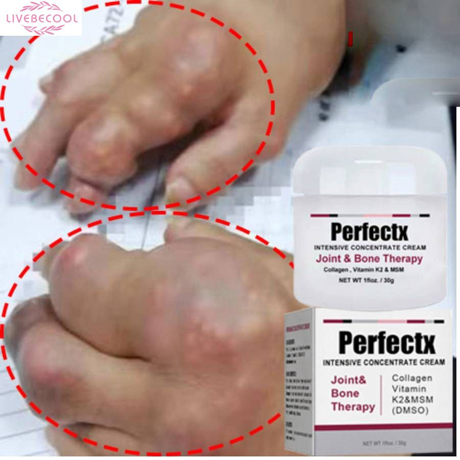 {TẶNG THUỐC} Kem Giảm Đau Giảm Sưng Xương Khớp Gout Penetrex Joint Bone cream CHÍNH HÃNG MỸ