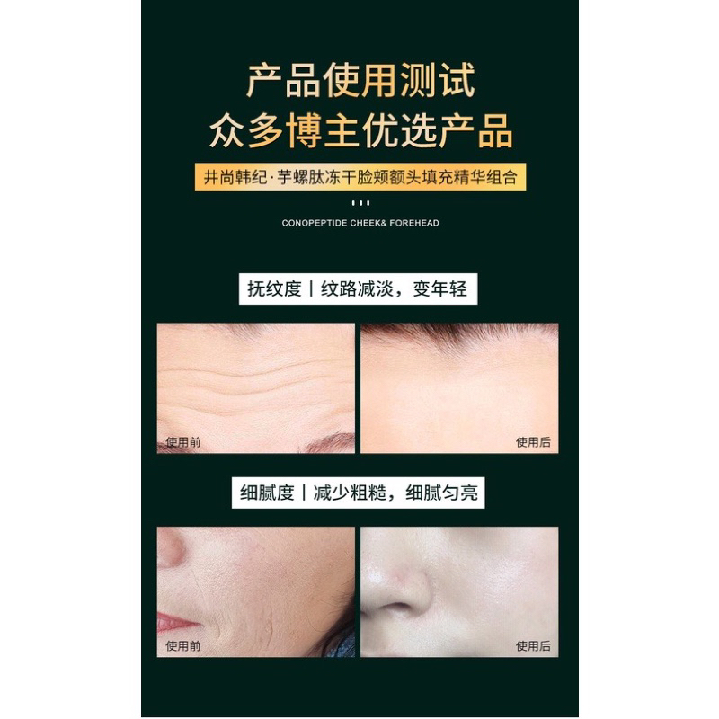 Tinh Chất Tái Tạo Tế Bào Gốc Collagen Jinshane - Bộ Tế Bào Gốc Collagen Jinshane Trẻ Hóa Da Mờ Thâm Nám