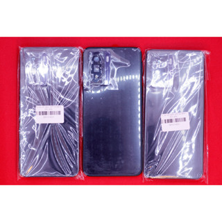 Vỏ bộ full Oppo A57 4G nhiều màu (gồm: lưng, xương, vành camera liền kính, phím hông) new zin