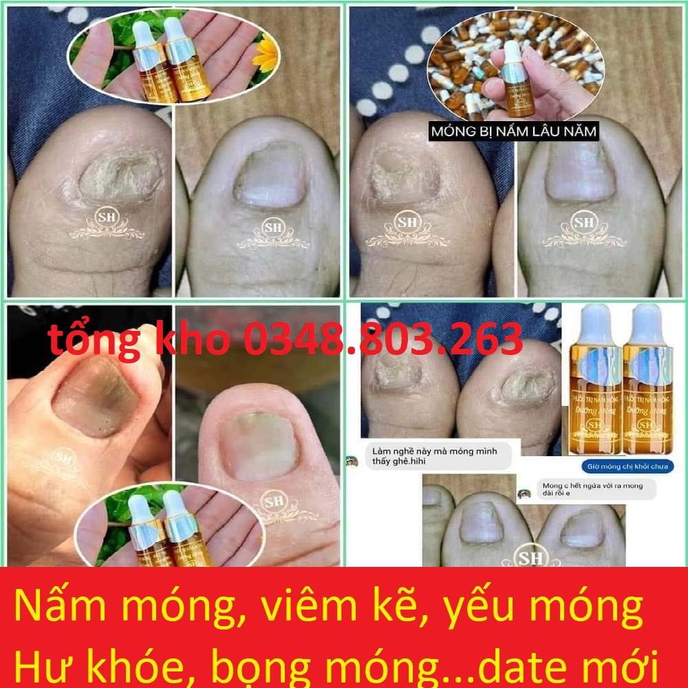 Serum nấm móng hỗ trợ đtri nấm móng tay chân