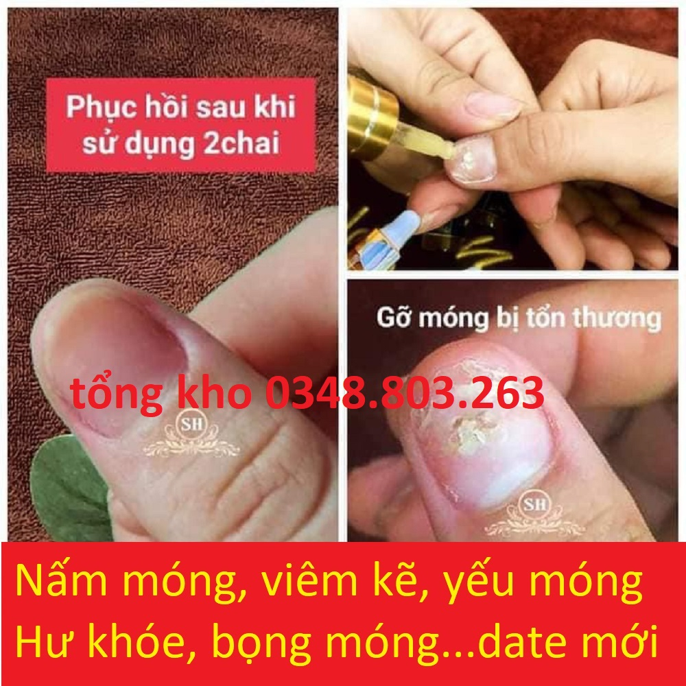 Serum nấm móng hỗ trợ đtri nấm móng tay chân