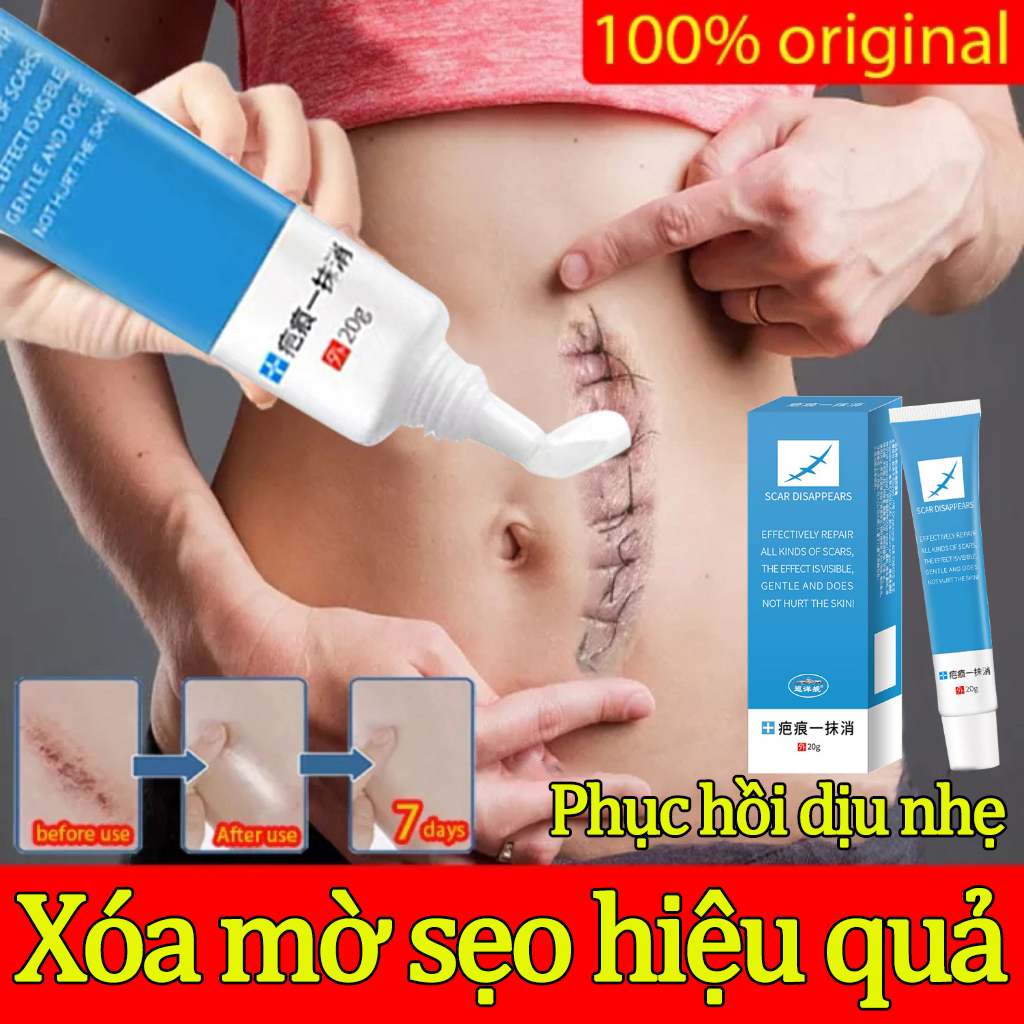 Kem che sẹo,Kem xóa Sẹo Thâm, lấp đầy Sẹo Rỗ, Sẹo Lõm,Kem Mờ Sẹo Mờ Thâm 20g Kem Giảm Sẹo Và Rạn Da,giảm rạn da hiệu quả