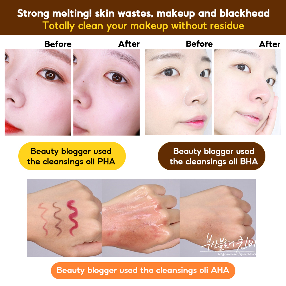 Dầu tẩy trang và loại bỏ mụn đầu đen Hanskin 300ml - BEBEAU