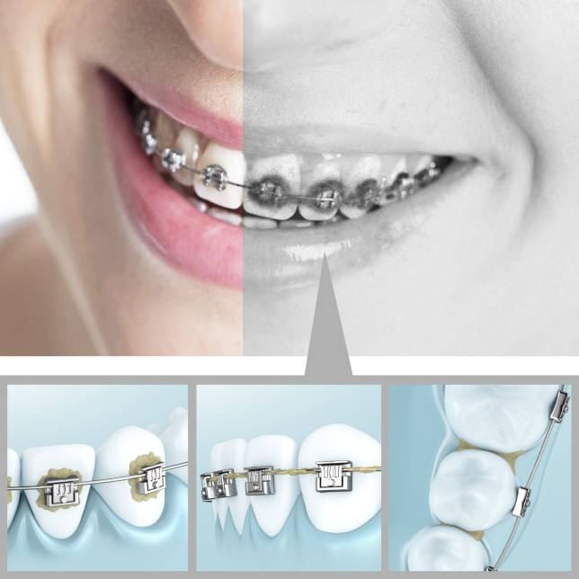 Máy Tăm Nước Panasonic EW1513W451 - Hàng Chính Hãng